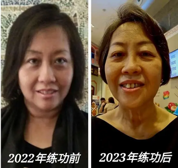 肌肉萎缩造成肌少症