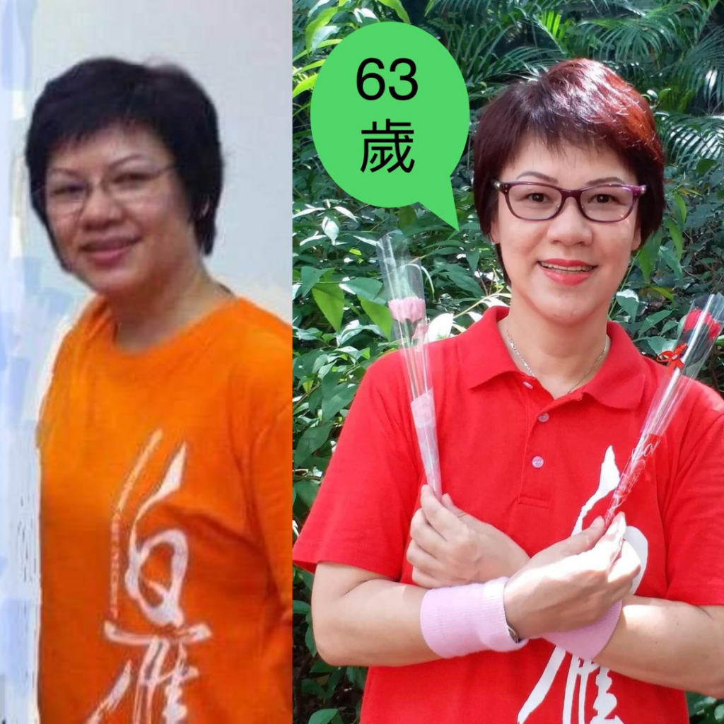 嚴重更年期症狀，子宮脫垂，水腫